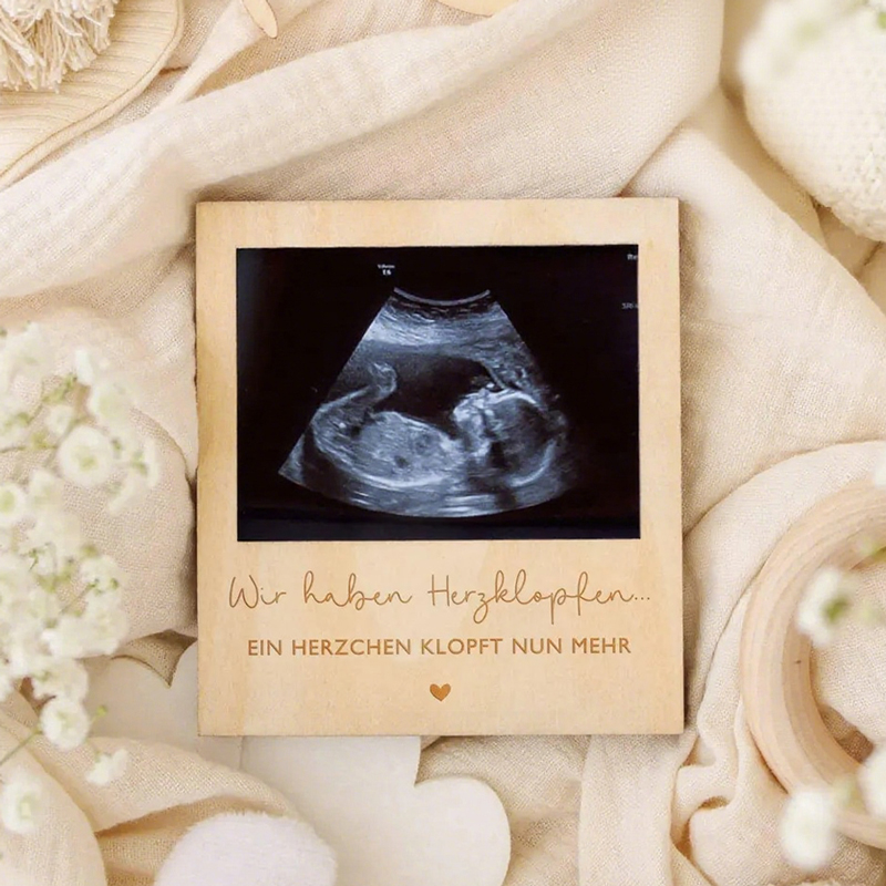 Engraved Wood Frame - Ultrason Gebelik Duyuru Levhası Ahşap Fotoğraf